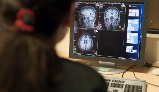 Images of brain scans on a computer