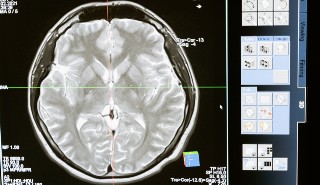 Image of a brain scan