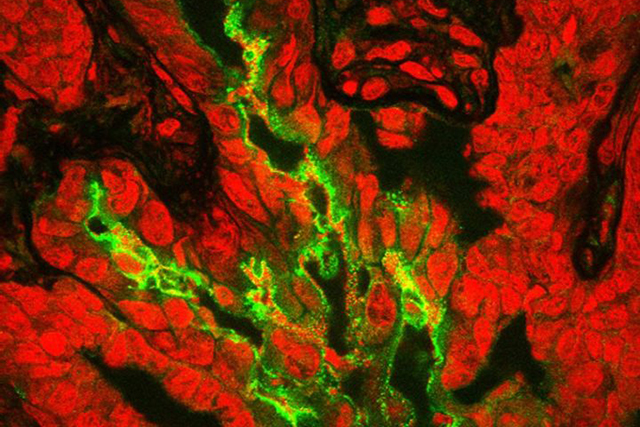 Microscopic photo of gut bacteria